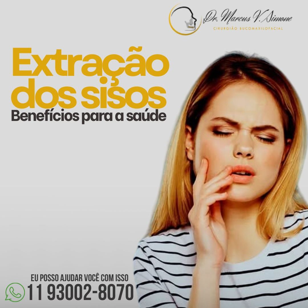 Extração dos Sisos-Benefícios para a saúde