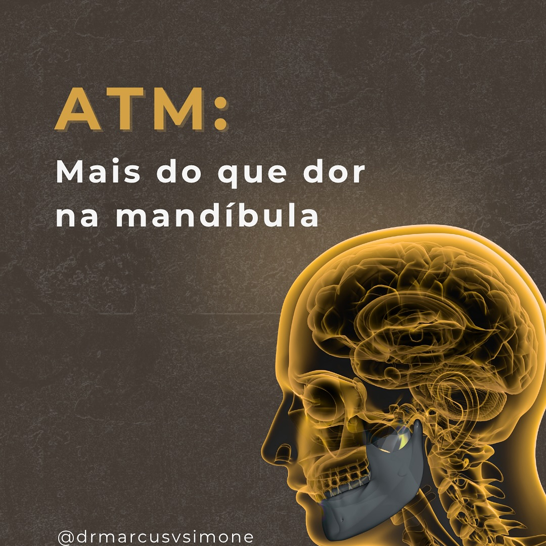 ATM - Mais do que uma dor na mandíbula-saiba mais