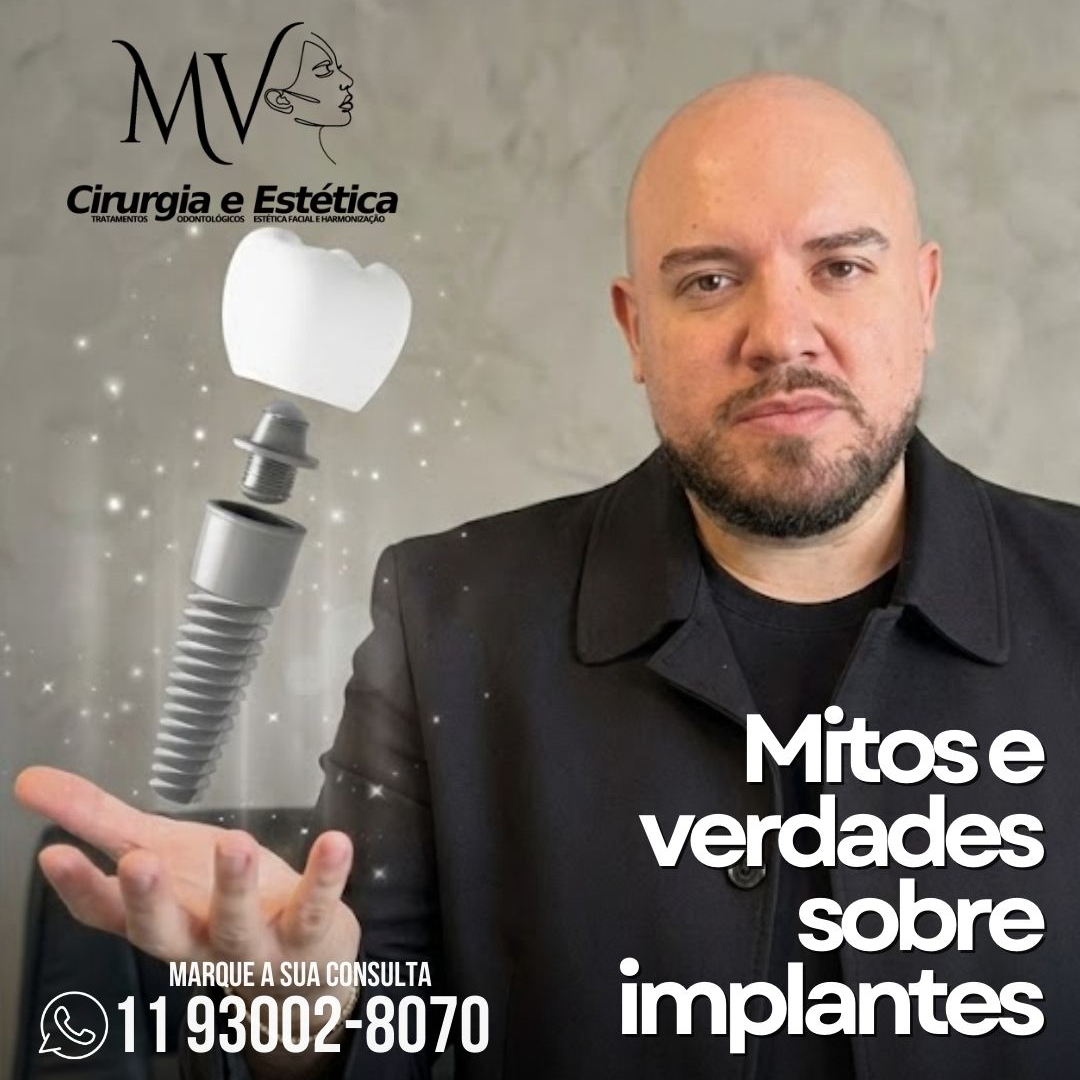 Mitos e verdades sobre implantes-saiba mais