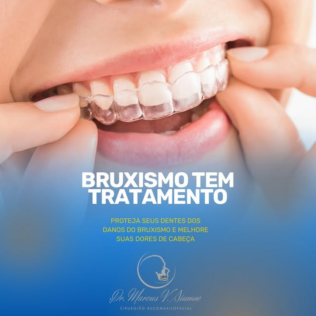 Bruxismo tem tratamento ?-Proteja seus dentes