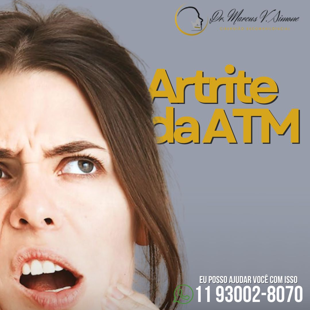 Artrite da ATM-Entenda melhor o que é isso