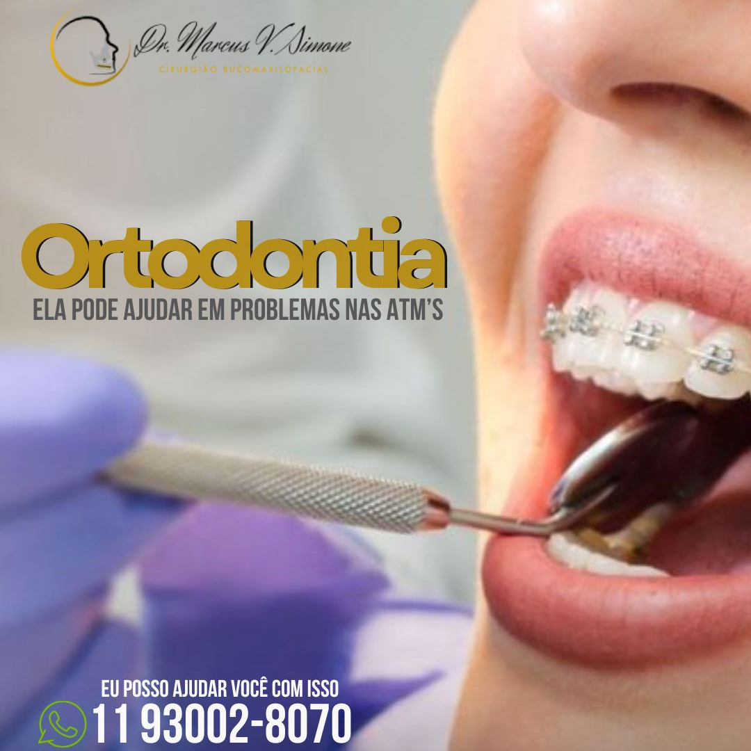 Ortodontia-como ela ajuda com problemas de ATM