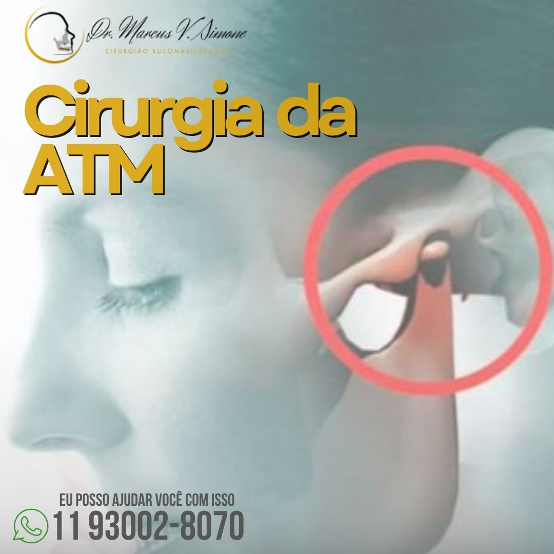 Cirurgia da ATM-saiba mais sobre ela