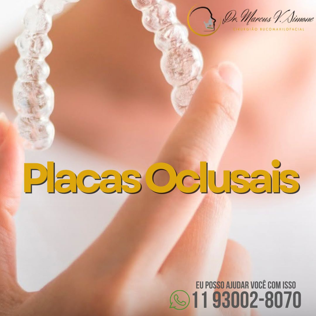 Placas oclusais-Ferramentas versáteis