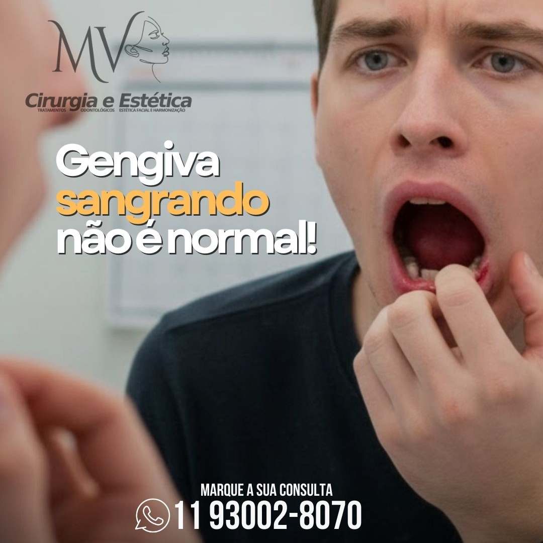 Gengivite-gengiva sangrando , não é normal