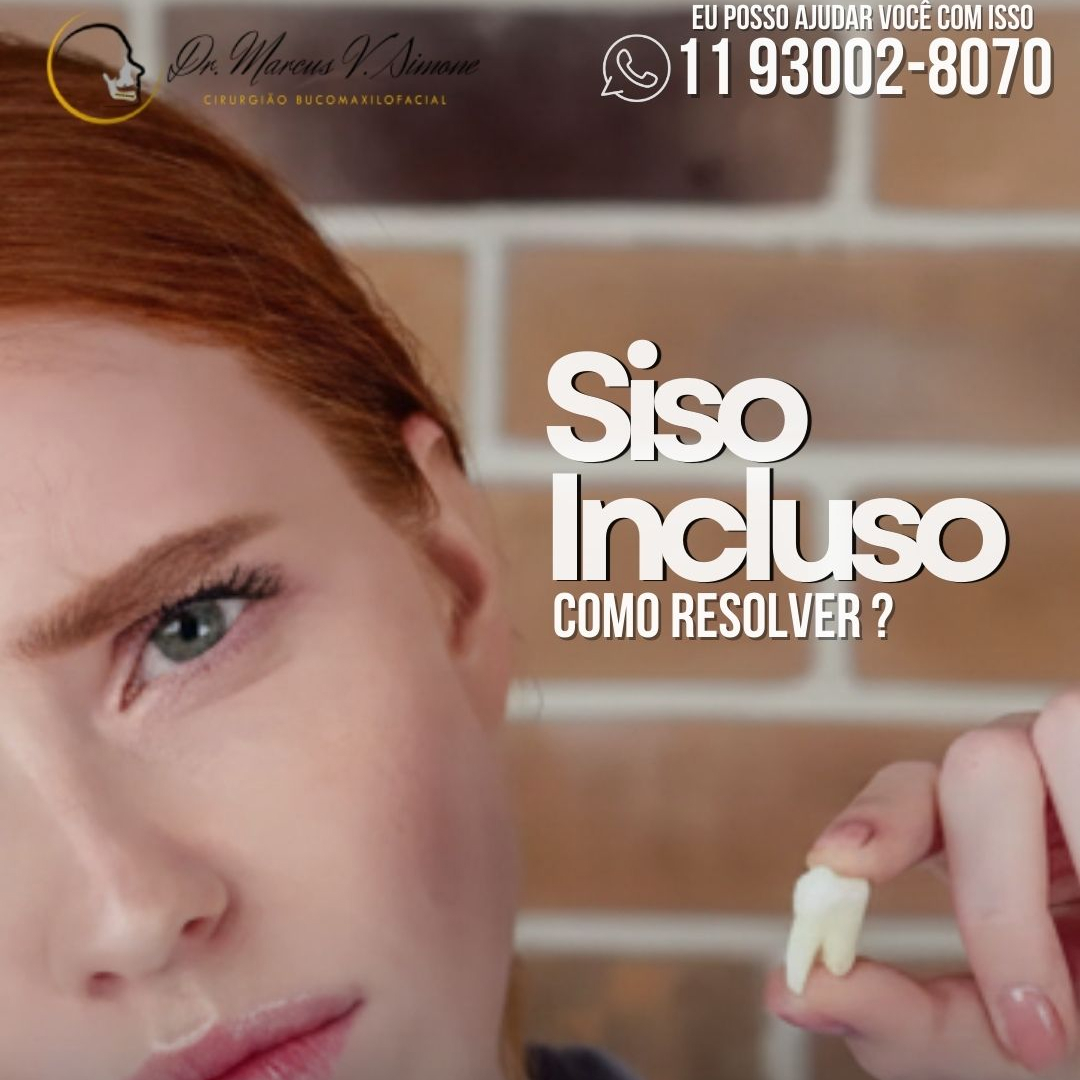 Siso incluso-como resolver
