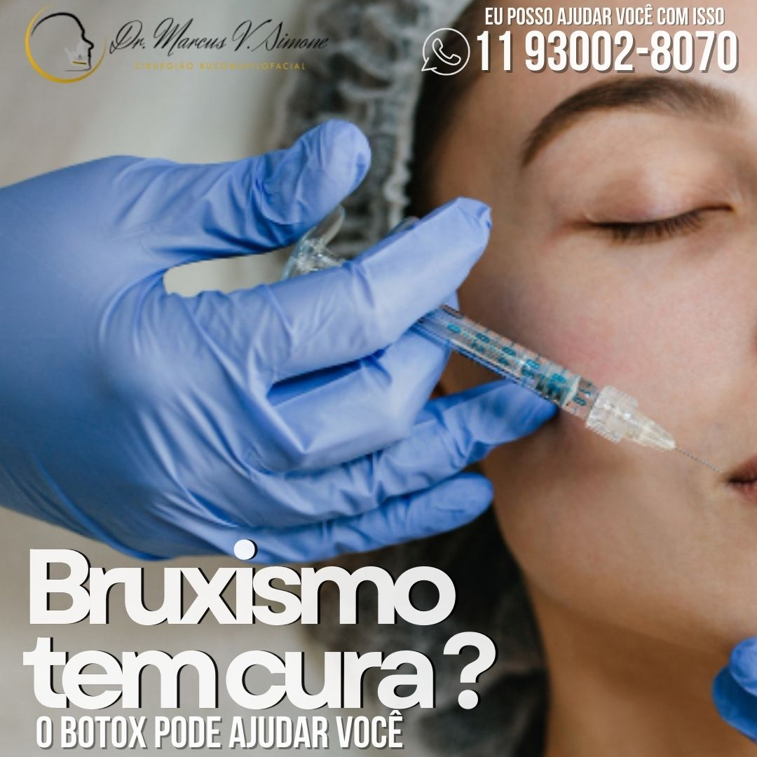 Bruxismo tem cura-o botox pode ajudar você